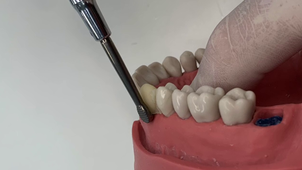 TUTO DÉPOSE COURONNE ET PINCES.mp4