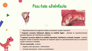 4. Fractures en denture temporaire_DIU LMNOP.mp4