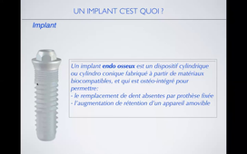 Introduction à la Prothèse Implantaire 4 ème année .mp4