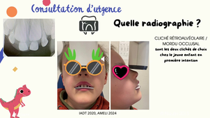 DIU Odontologie pédiatrique Lyon - Nice - Marseille TRAUMATOLOGIE Module 2.mp4