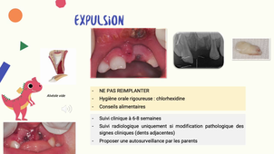 DIU Odontologie pédiatrique Lyon - Nice - Marseille TRAUMATOLOGIE Module 3.mp4