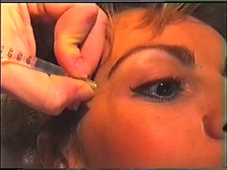 NM - FV 2 - pique oeil