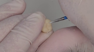 TUTO RÉGLER UNE SURROCLUSION.mp4