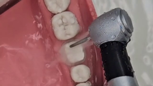 TUTO RATTRAPER UN AXE TROP CONVERGENT.mp4