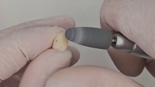 TUTO RÉGLER UN SURCONTOUR.mp4