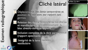 2.2 - Démarche diagnostique et classification des traumas.mp4