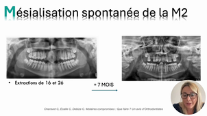 1. Molaires compromises_CC AEU26