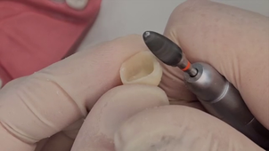 TUTO REBASAGE PROVISOIRE.mp4